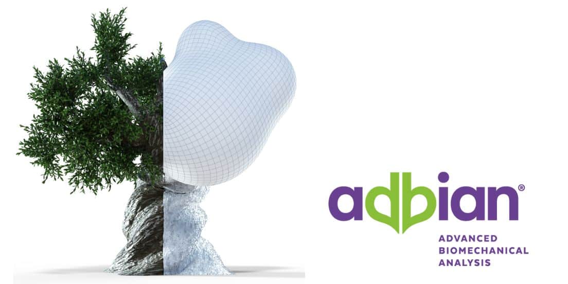 Advanced Biomechanics and 3D Modeling Are Revolutionizing Urban Tree Risk Assessment and Sustainable City Planning